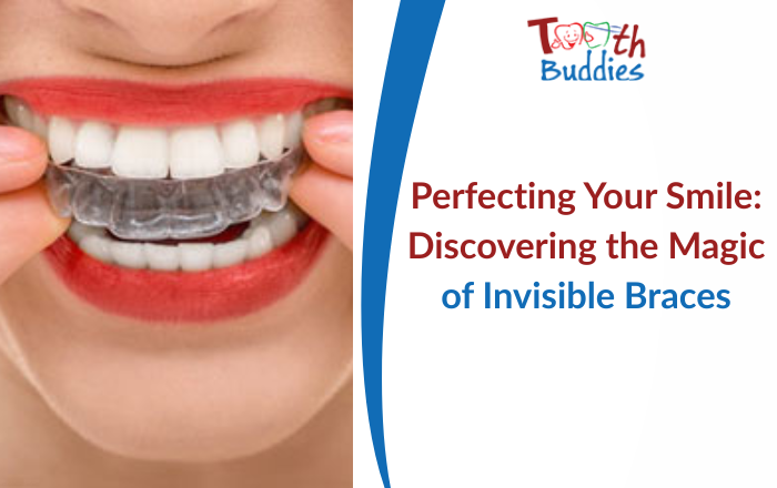 Perfecting Your Smile: Discovering the Magic of Invisible Braces