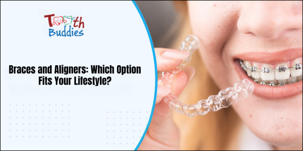 Braces and Aligners: Which Option Fits Your Lifestyle?