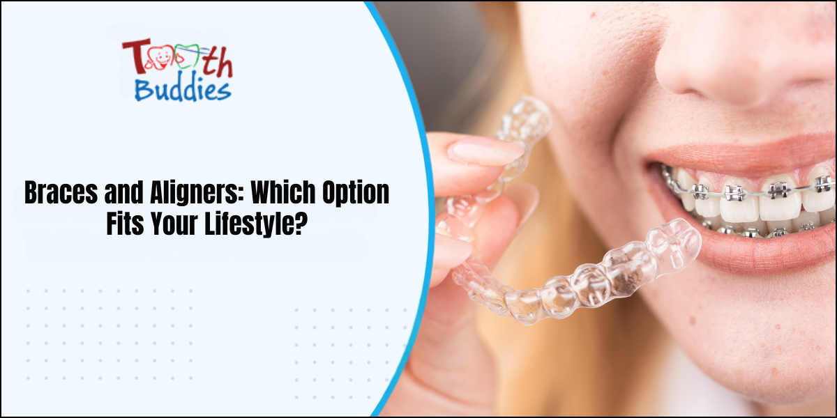 Braces and Aligners: Which Option Fits Your Lifestyle?