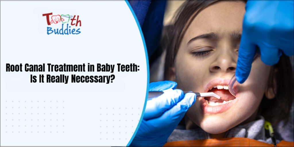 Root Canal Treatment in Baby Teeth: Is It Really Necessary?